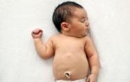 Кожа грудного ребенка: особенности, функции и уход Обрабатываем пупочную ранку по всем правилам